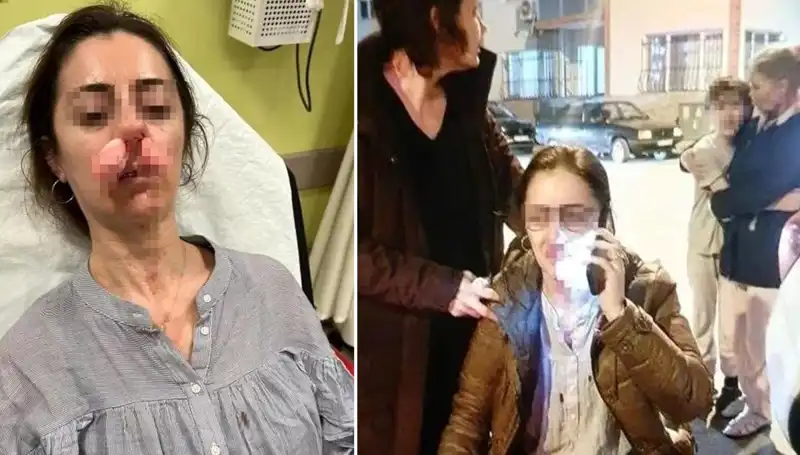 Bir Otomobil Kapısı: Eşini Aldatan Adamla Hesaplaşma Yolu!