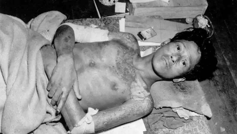 80 Yıl Sonra Nagasaki’den Korkutucu Uyarı: Nükleer Felaket Tehdidiyle Yüzleşiyoruz