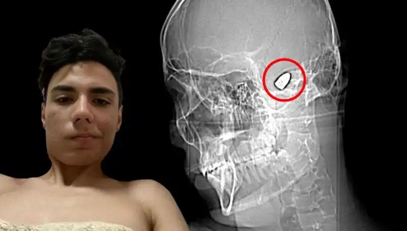 Zihinlerin Derinliklerinde Tehlikeli Bir Yolculuk: Patlamaya Hazır Bomba