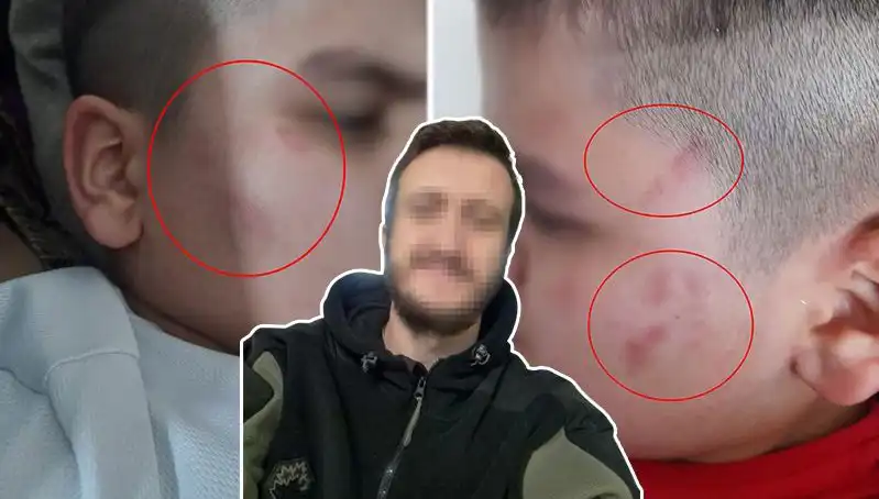 Otizmli Çocuğa Okulda Dayak İddiası: Konunun Yansımaları