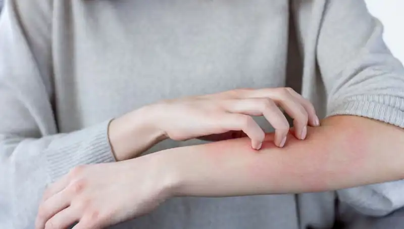 Cilt Kanseri Belirtileri: Dermatologdan Kaçırılmaması Gereken İki İşaret