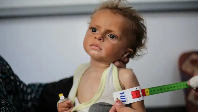 İngiltere, 300 Gazzeli Çocuğa Yeni Bir Gelecek Sunmaya Hazırlanıyor