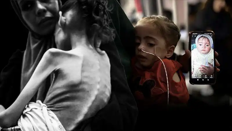 Küçük Meryem’in Açlık Mücadelesi: 25 Kilodan 10 Kiloya D düştü!